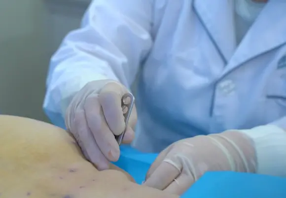 成都西部痛风风湿医院方氏风湿痹诊疗法被列入区级非物质文化遗产(图4)